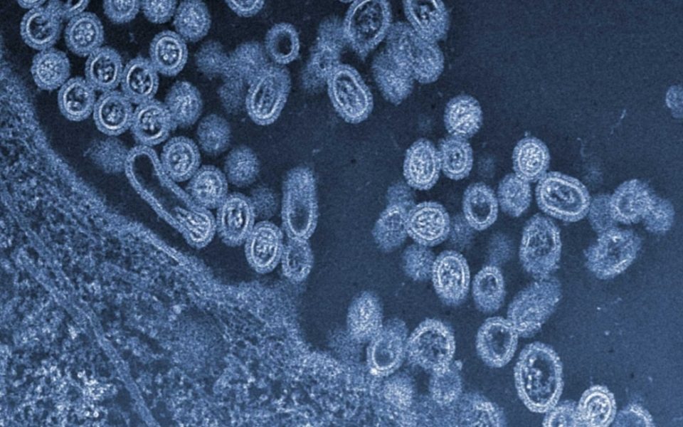 Во Кина регистриран смртен случај од инфекција од комбинација на два соја на птичји грип