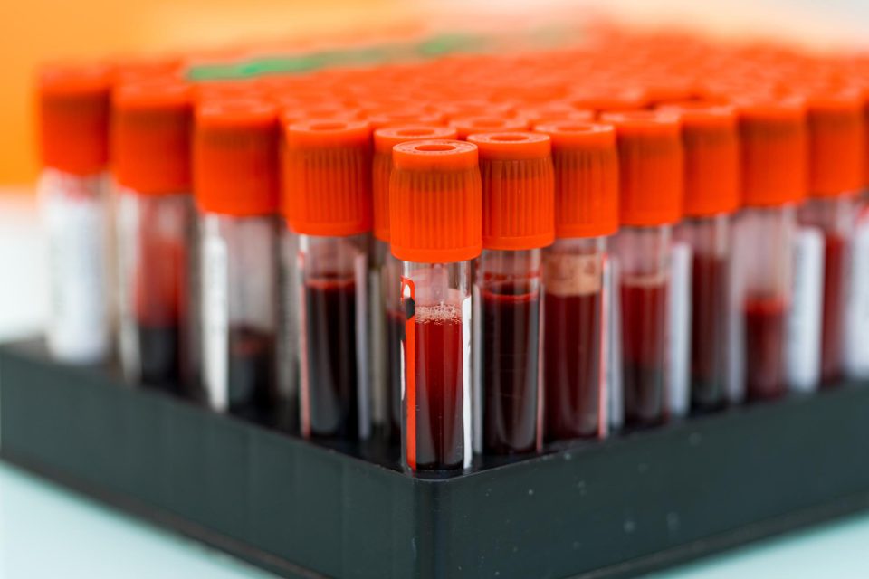Тест на крвта што може да предвиди болести до 10 години однапред