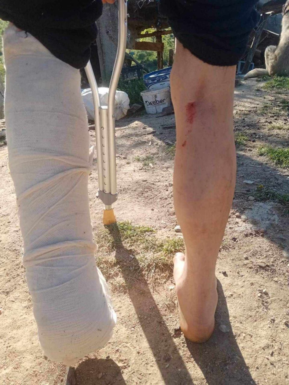 ФОТО: Мечка нападнала и тешко повредила 61-годишен маж на планината Мукос, во атарот на с.Оморани
