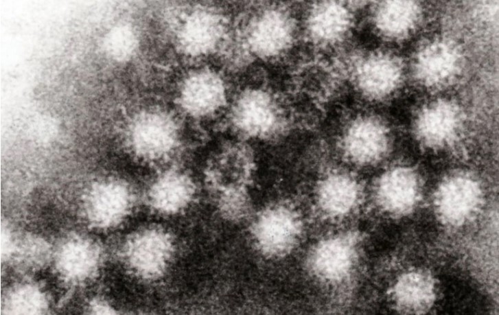 Дијареја, мачнина, грчеви или треска – над 900 луѓе заразени со норовирусот
