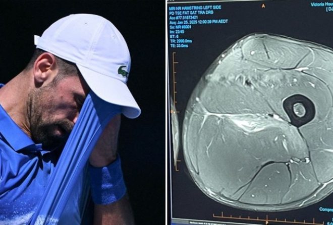 Ѓоковиќ објави доказ за повредата: За сите спортски „експерти“… (ФОТО)