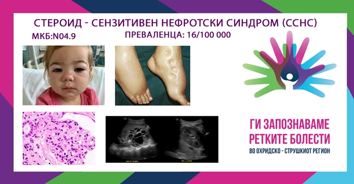 Ги запознаваме ретките болести во охридско – струшкиот регион 2025