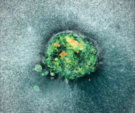 ВИДЕО: Научници направија прва снимка од имплантација на човечки ембрион во матка