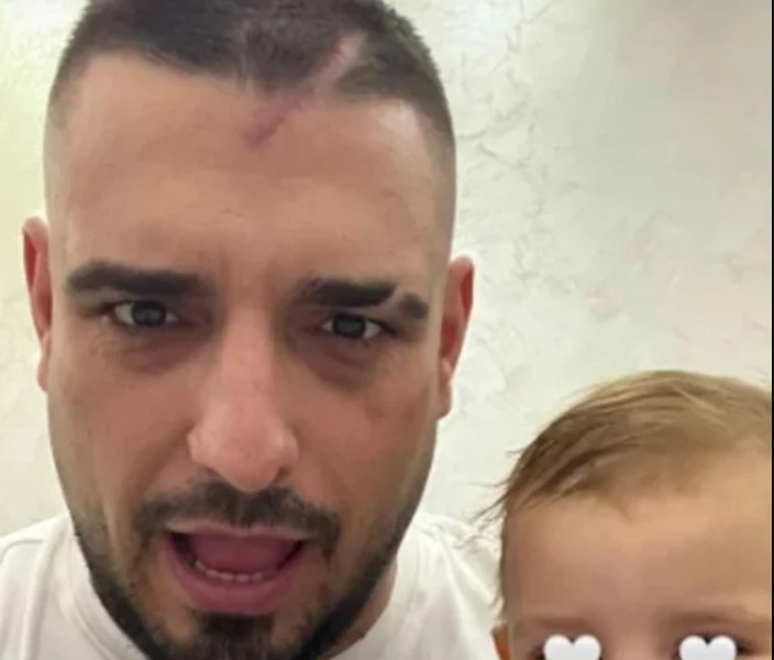 Лузната на Дарко Лазиќ открива колку сериозно се повредил во сообраќајната несреќа