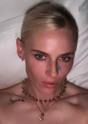 Девојката со златните нозе: Лекарите ја нашле на под, за да ја спасат и ги ампутирале нозете, животната приказна на познатата манекенка