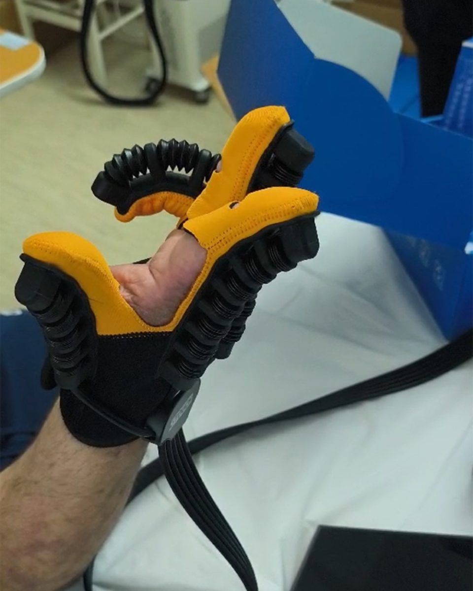 Општата болница Кочани доби донација 90 комплети ракавици за пасивна рехабилитација