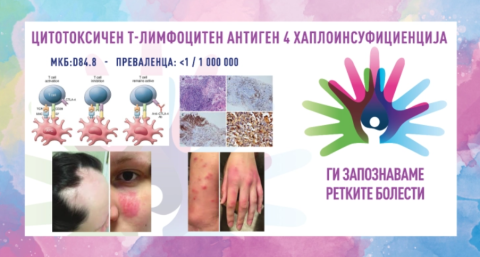 Ги запознаваме ретките болести“ Цитотоксичен т-лимфоцитен антиген 4 хаплоинсуфициенција