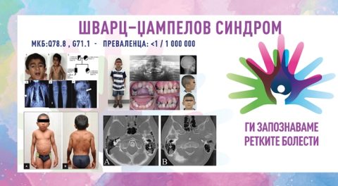 Ги запознаваме ретките болести: ШВАРЦ–ЏАМПЕЛОВ СИНДРОМ